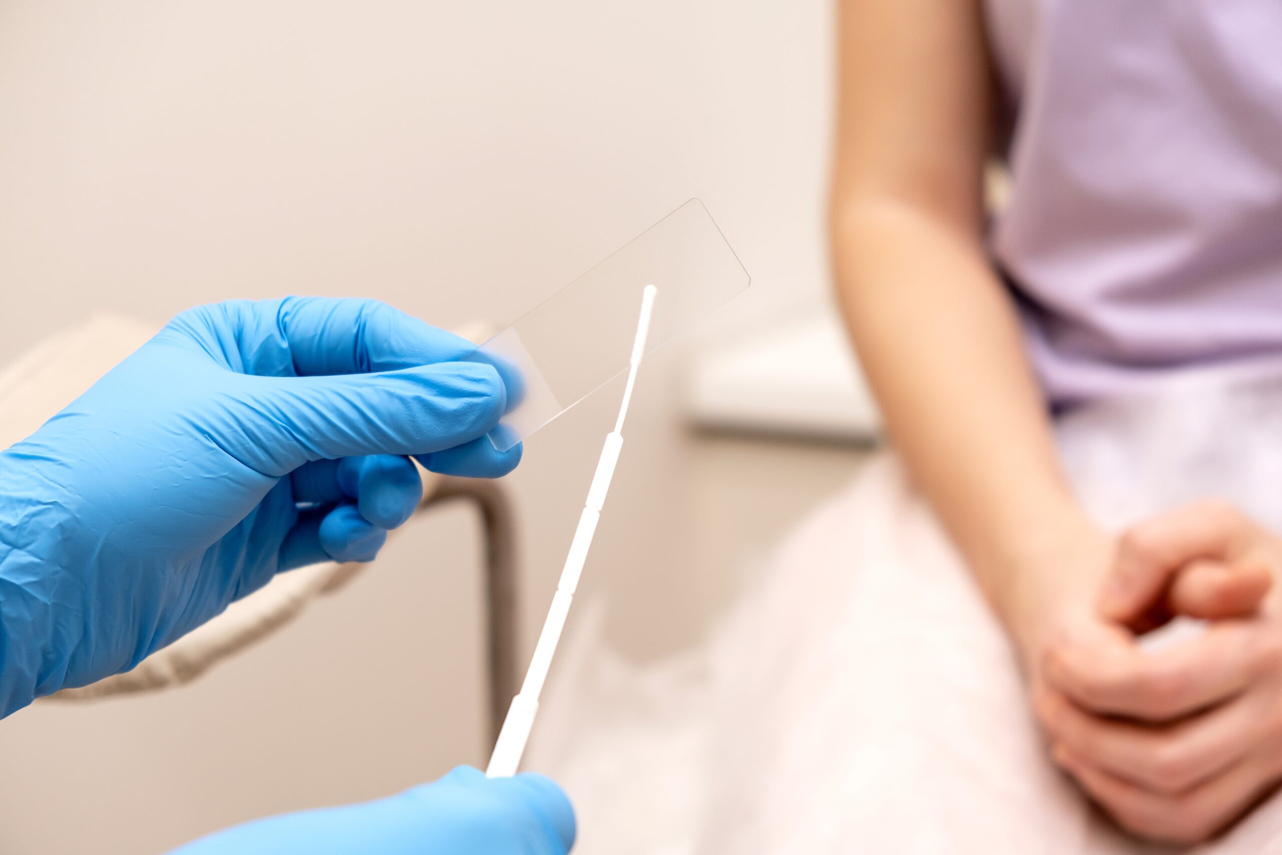 pap smear