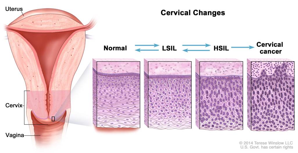 maksud keputusan ujian pap smear