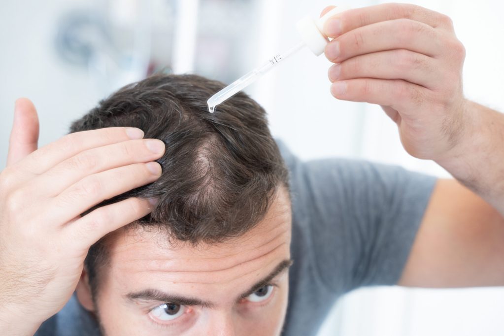 Man applying topical finasteride scaled 1